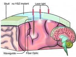 «Окно в мозг» поможет в лечении многих заболеваний