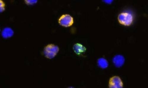 F28c436a8a72f22258e5a245729a0e0b