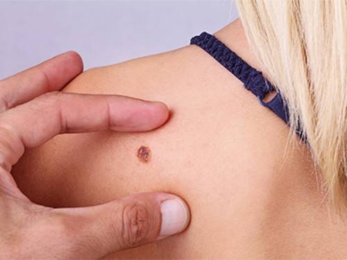 4601cc2494f4df4a0814f9a6cba429c7