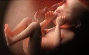 334de8a9de7af8459663574a95762e96