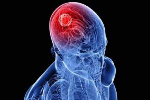 D02a528f699df88c078dd309396df4d9