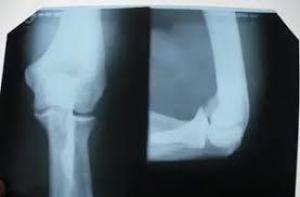 579ed99ee29924e213aaffb9613d5467