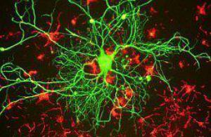 5fdc4d3a047460509cd2f6670cde0eb9