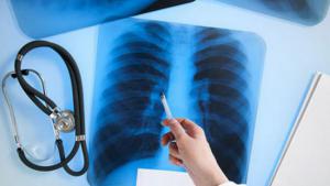 B48597563d03fe5220e33613ac93d888