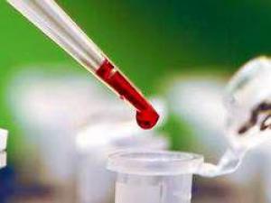 7fba792c8b8a0ff1567593b61fc80137