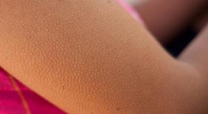 96cd4b8d32520e485d69ef1b4cc79d3f