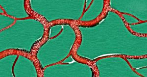 C1fd380e1518d3bfbe4b216ce69c7fa1