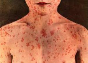 Ec125b149fcd03425407c9897f5378ec