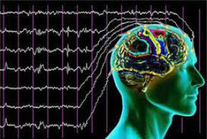 Ac86a195d5a1ce4b2299b522088378d9