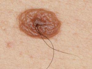 B9b81b1aa0e0b719dac05284e5b2a411