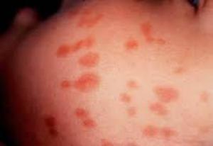 070cacee4ff46e4cce268fbfdaea1633