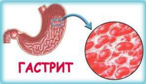 A44383e73bf920a06586492c019c5683