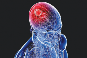 72b73311eedf0a5a12a5696b3934e583