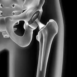 926f29ec71c2f771f680fc2187c03209