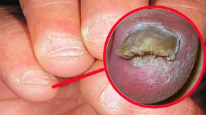 F688b56703677be3c46f3a2ac83bbf2a