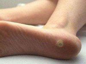 1d7b45a4acf7a0d329e1a9524b6658ef