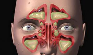 19b6fc3294169dbc5175ff0b4e75de5e