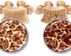 D07e4520354589f5799ae97c49e1f064