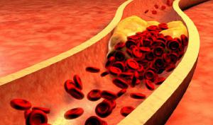 D85b49a86722992ff7e5cf3af2856af2