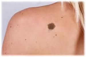 00d697e861cfa713c8d48be6dbe98301